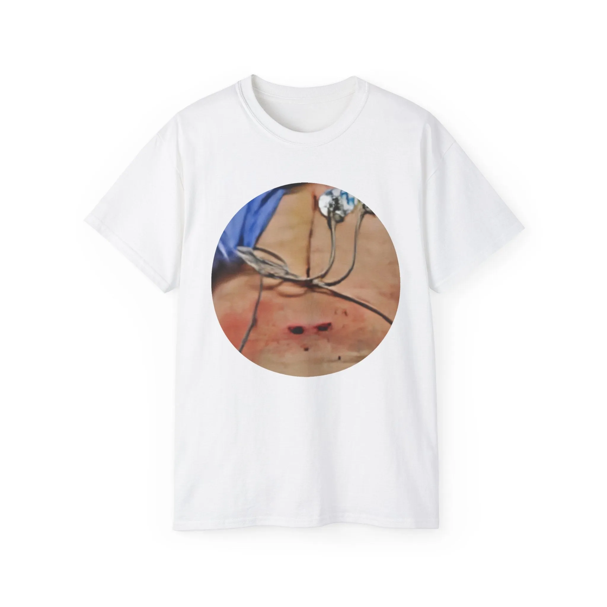 Gildan 2000 Unisex Adult Ultra Cotton Medical Shirt CABG X 6